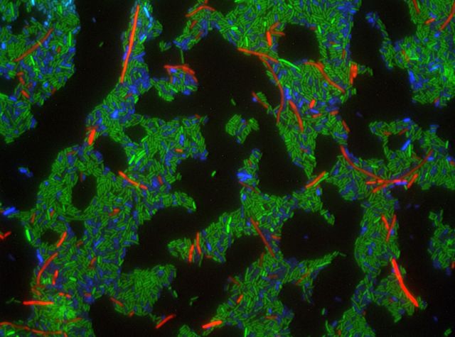 CDI+ inhibitor cells (green) were co-cultured with immune (blue) and non-immune (red) target bacteria, then visualized using fluorescence microscopy. The inhibitor cells deploy a potent DNase that causes intoxicated bacteria to form long filaments.